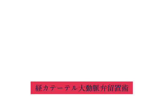 TAVI Transcatheter Aortic Valve Implantation 経カテーテル大動脈弁留置術 重症大動脈弁狭窄症に対する最新のカテーテル治療